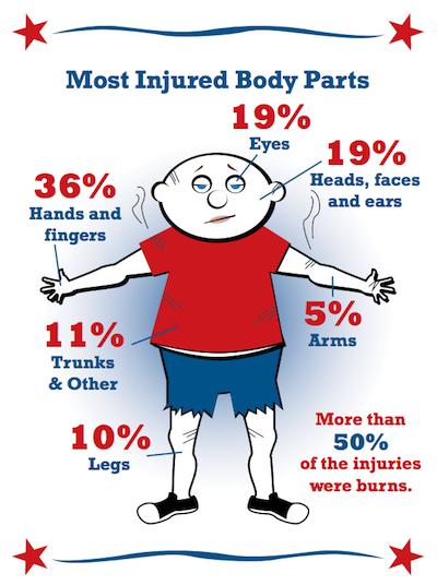 Most Injured Body Parts from Fireworks