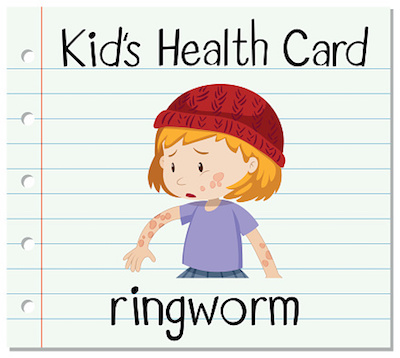 Kids Health Card Ringworm