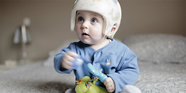 Pediatric Plagiocephaly Program