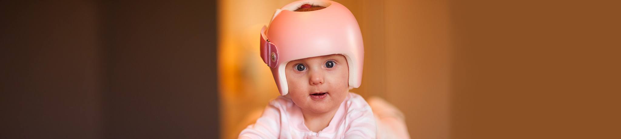 Baby with protective head gear