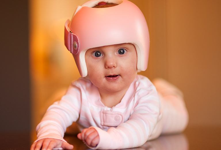 Baby with protective head gear