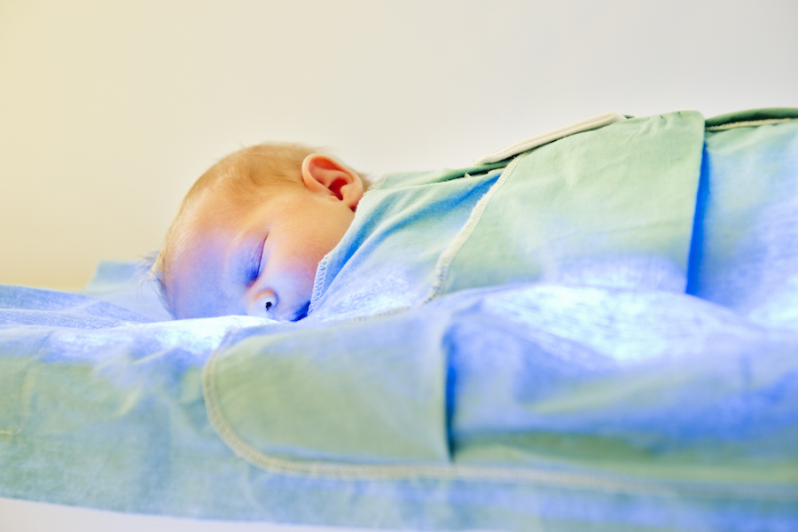 Why does my baby's skin look yellow? Orlando Health Arnold Palmer