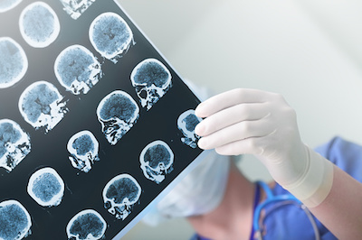 EEG Film
