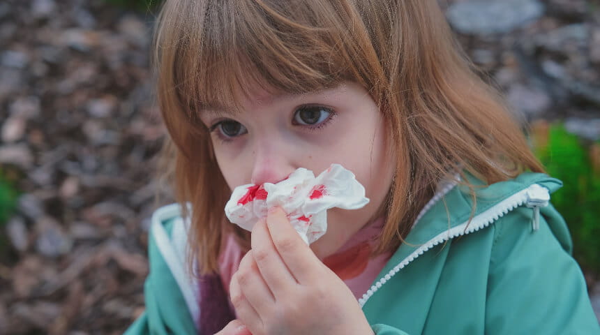 Child with a nosebleed